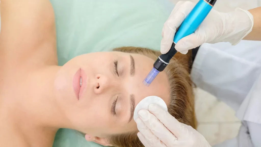 microneedling for eyebrows