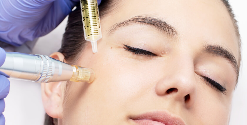 Mesotherapy downtime