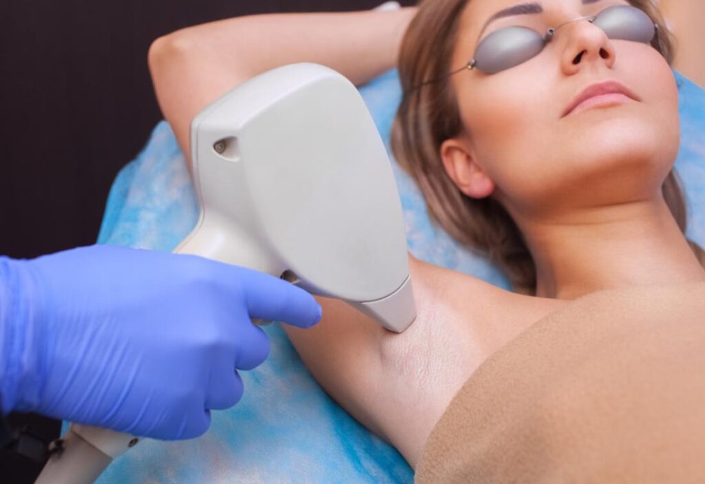 Laser Hair Removal on Your Face